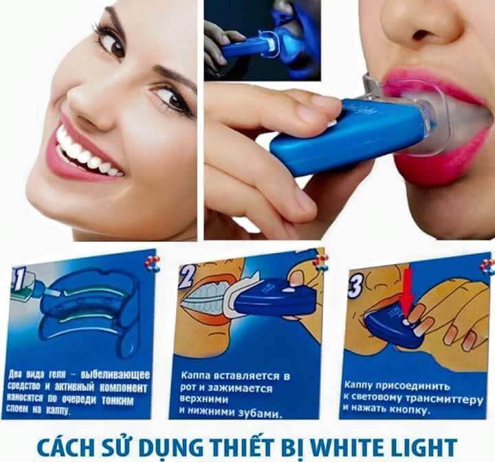Dụng cụ làm trắng răng White light có tốt không?