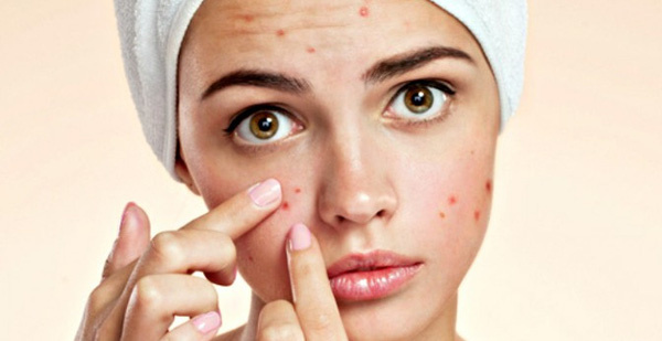 Top 3 máy hút mụn giá rẻ đáng mua hiện nay