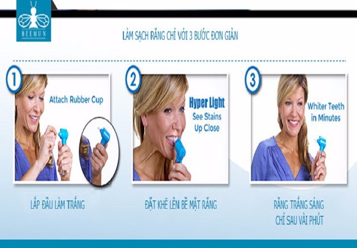 Dụng cụ làm trắng răng Luma Smile
